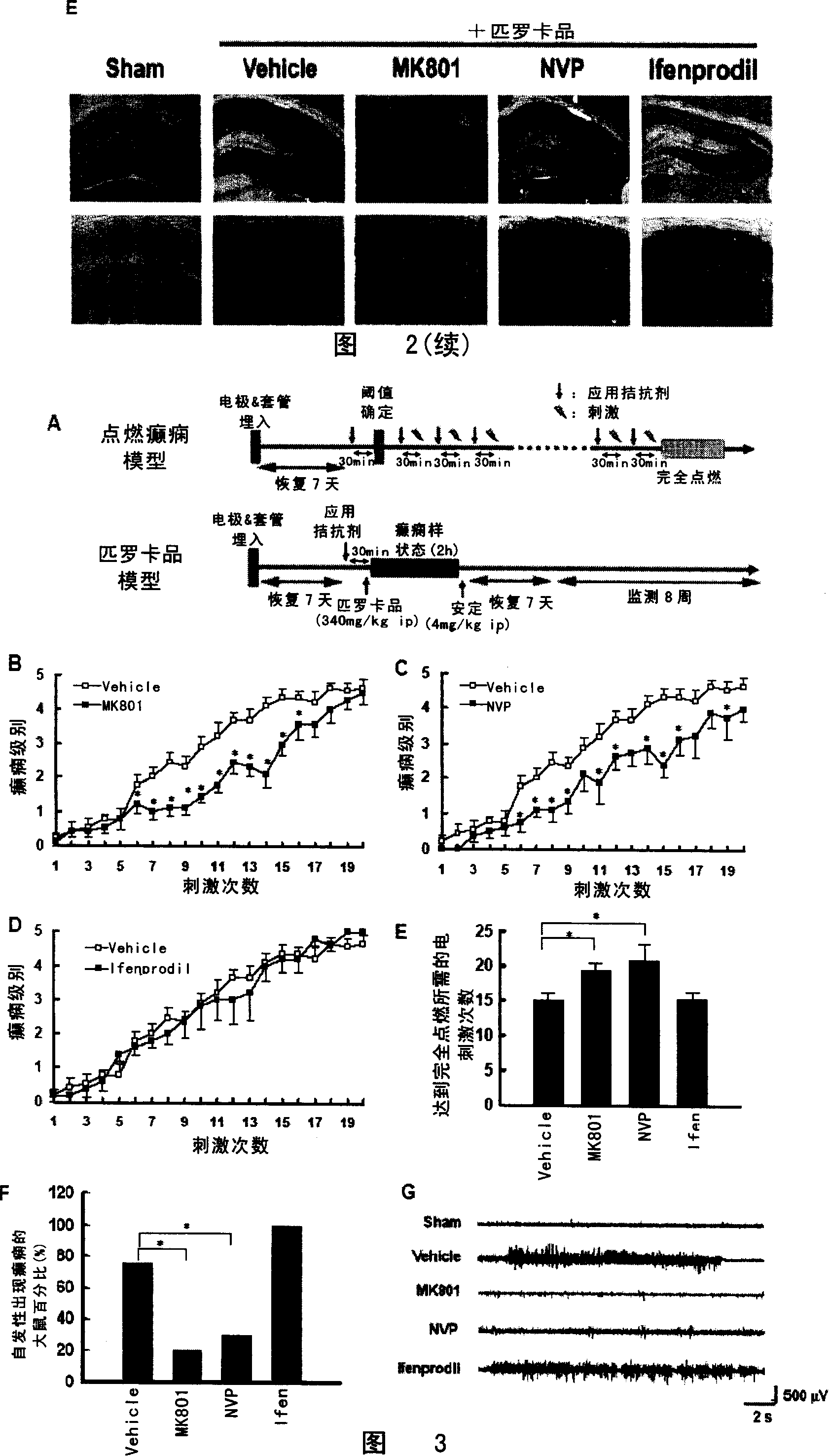 Effect of N-methyl-D-asparagic acid acceptor in epilepsy generation