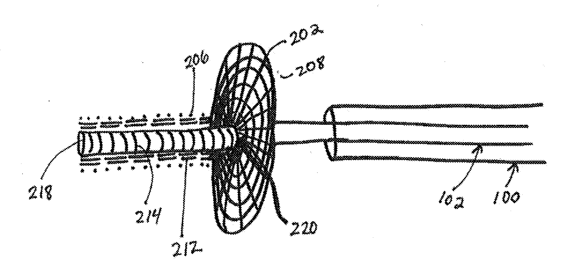 Aneurysm cover device for embolic delivery and retention