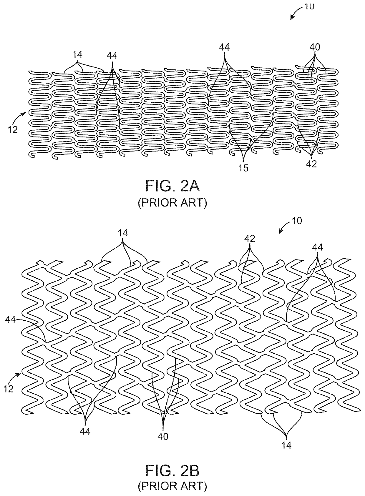 Uncaging stent