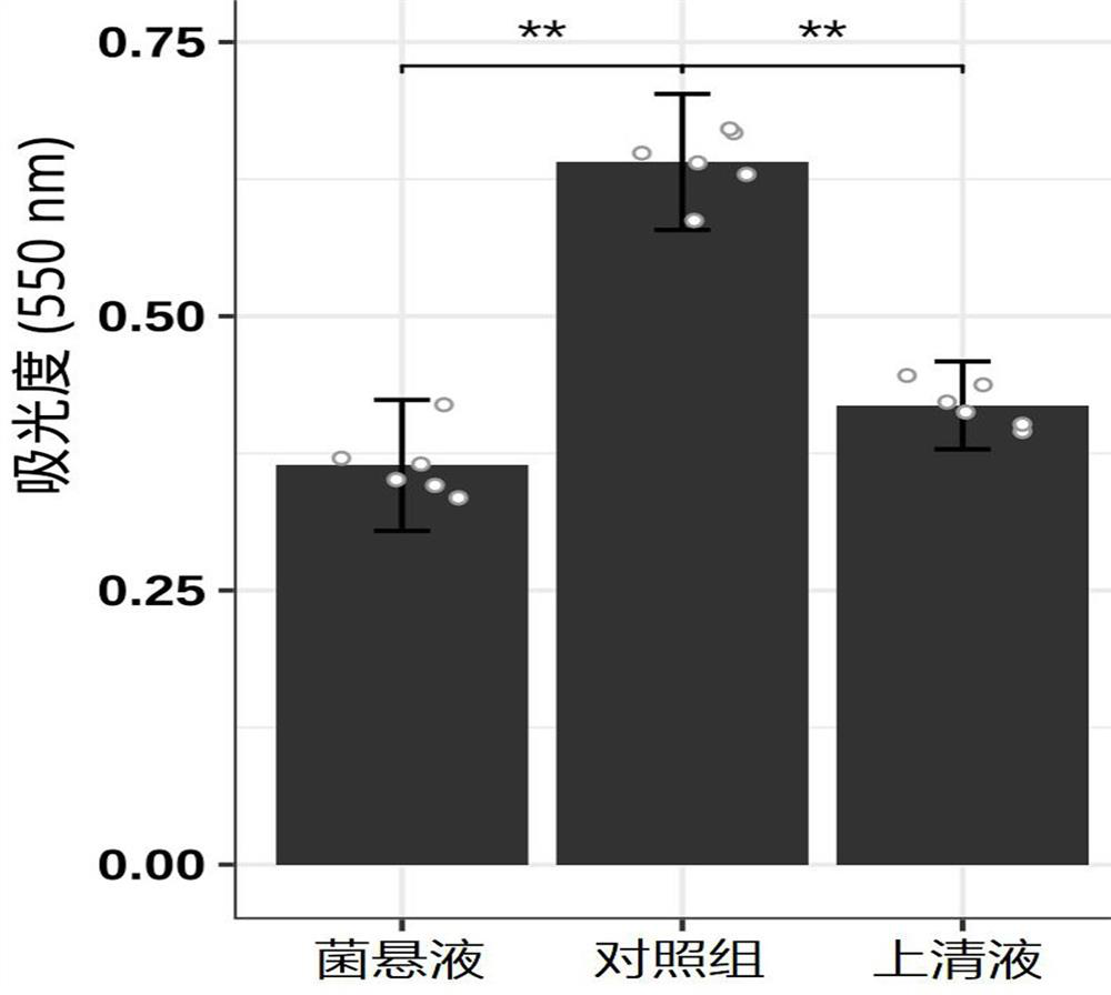 A kind of Lactobacillus plantarum against Helicobacter pylori infection and its application
