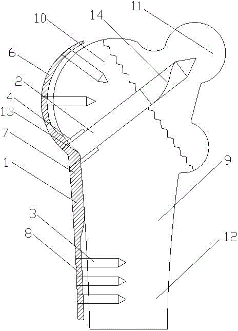 Bone connecting device for treating femoral intertrochanteric fracture