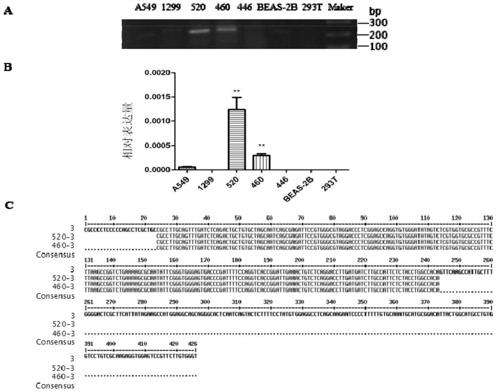 A retrotransposable gene l1-fggy and its use as a marker for lung squamous cell carcinoma