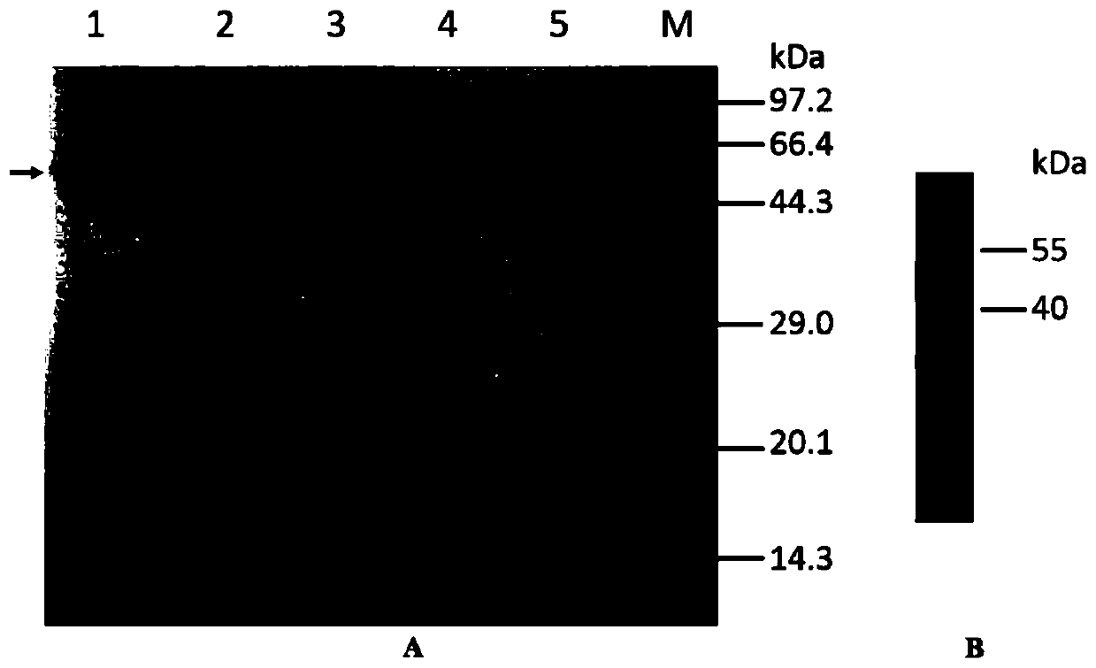 Camel-derived nano antibody capable of being specifically combined with carbonic anhydrase IX and application of camel-derived nano antibody