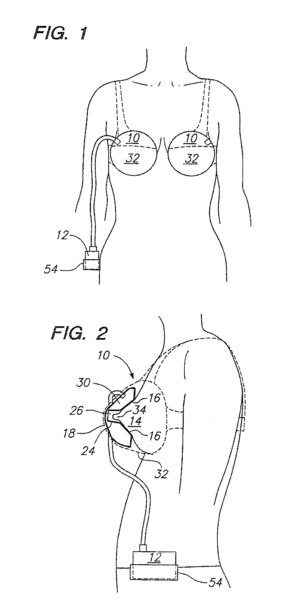 Breast pump device with self-contained breast milk reservoir