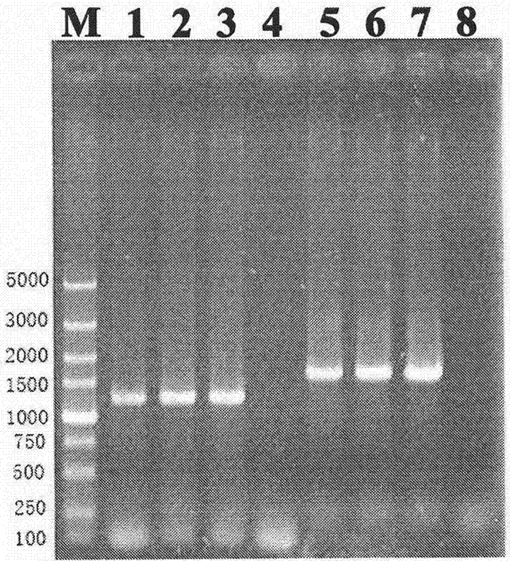 High yield tetramethylpyrazine saccharomyces cerevisiae and construction method thereof