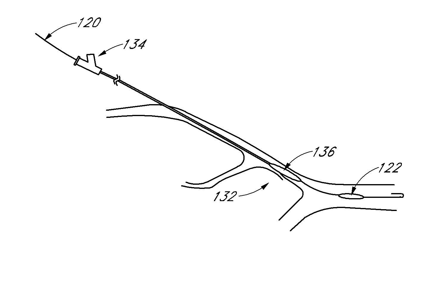 Method and devices for flow occlusion during device exchanges