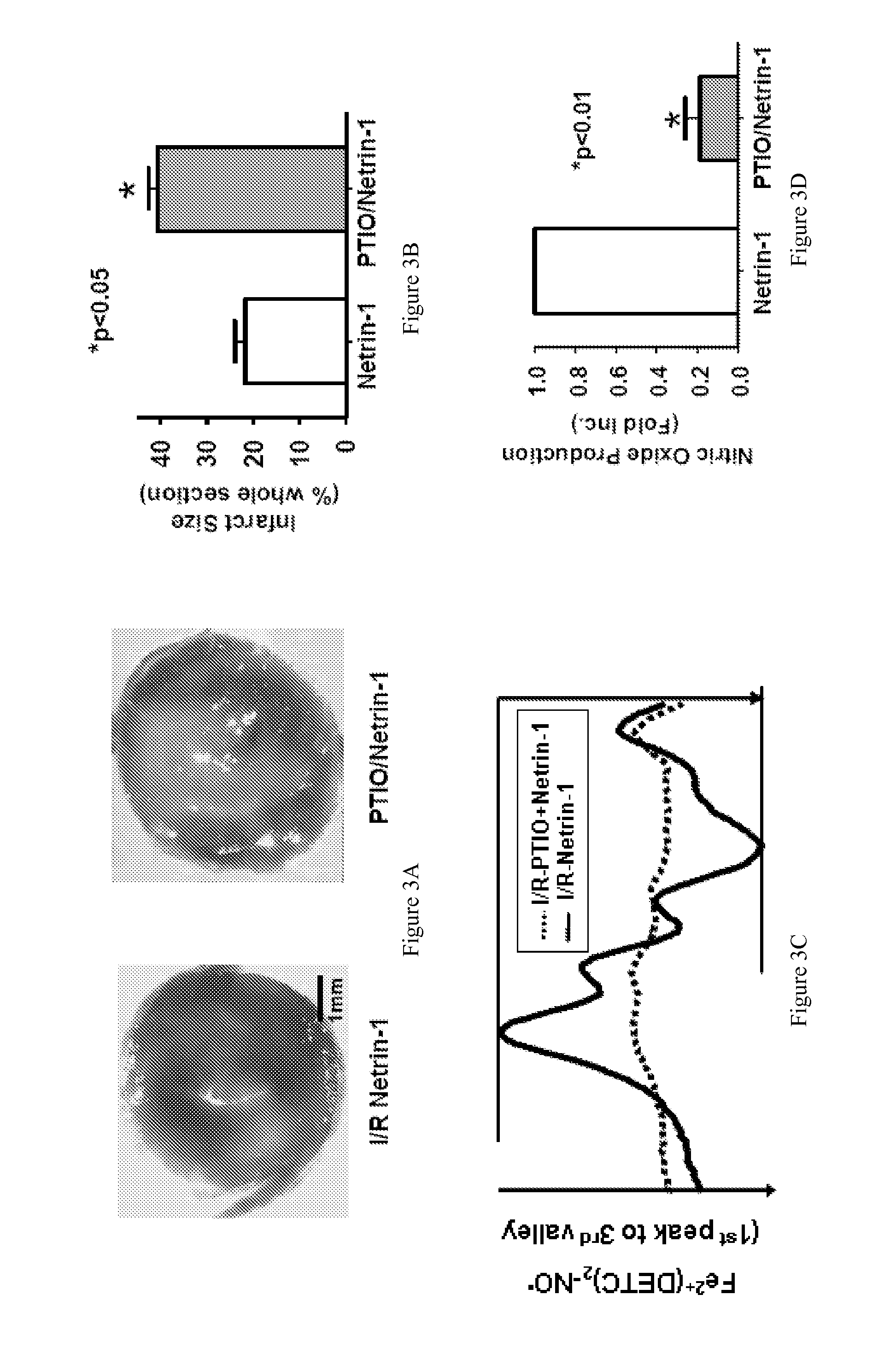 Treatment of Myocardial Infarction and Vascular Injury with Netrin-1