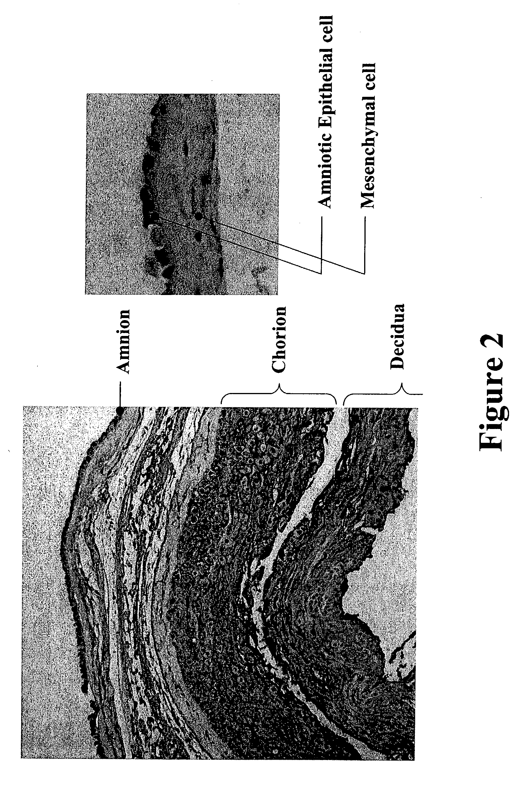 Placental derived stem cells and uses thereof
