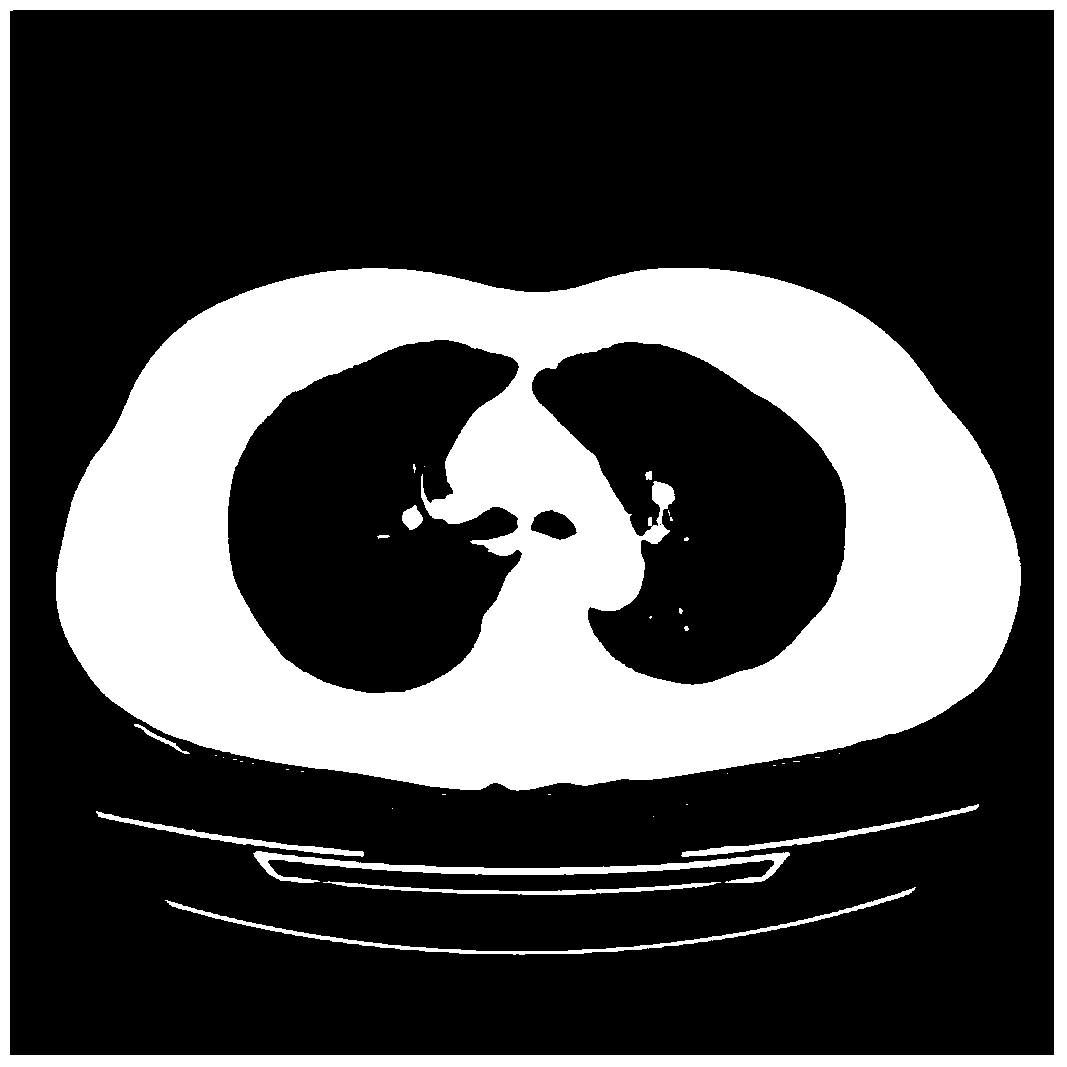 Automatic segmentation method of random walk CT lung tissue images based on prior information