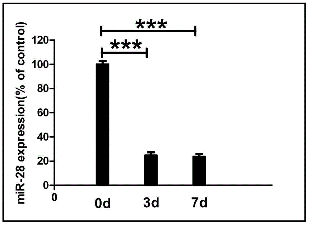 miRNA-28 compound as chronic pain marker and application of compound in preparation of medicine for treating chronic pain