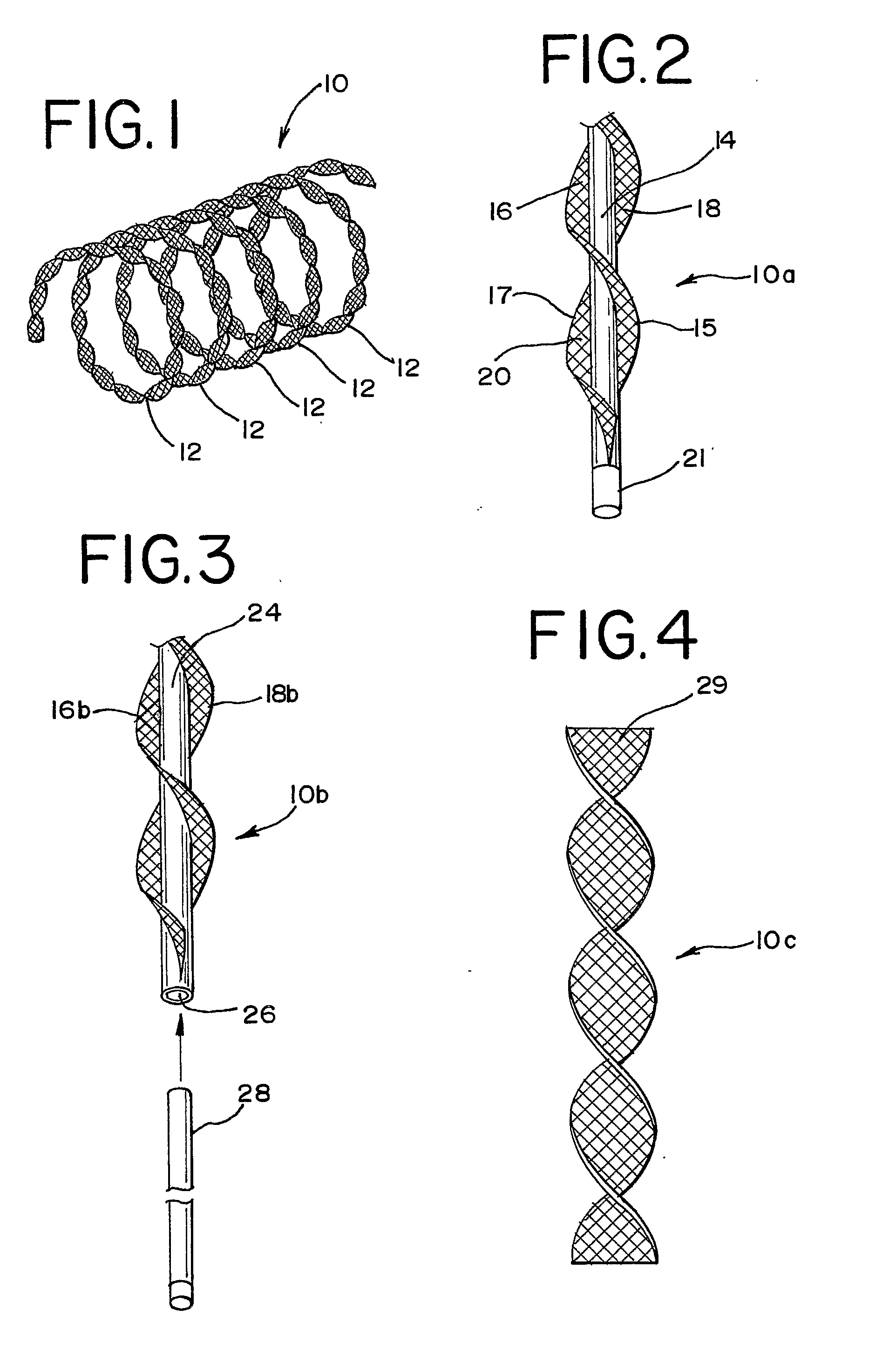 Vascular Occlusion Device With An Embolic Mesh Ribbon