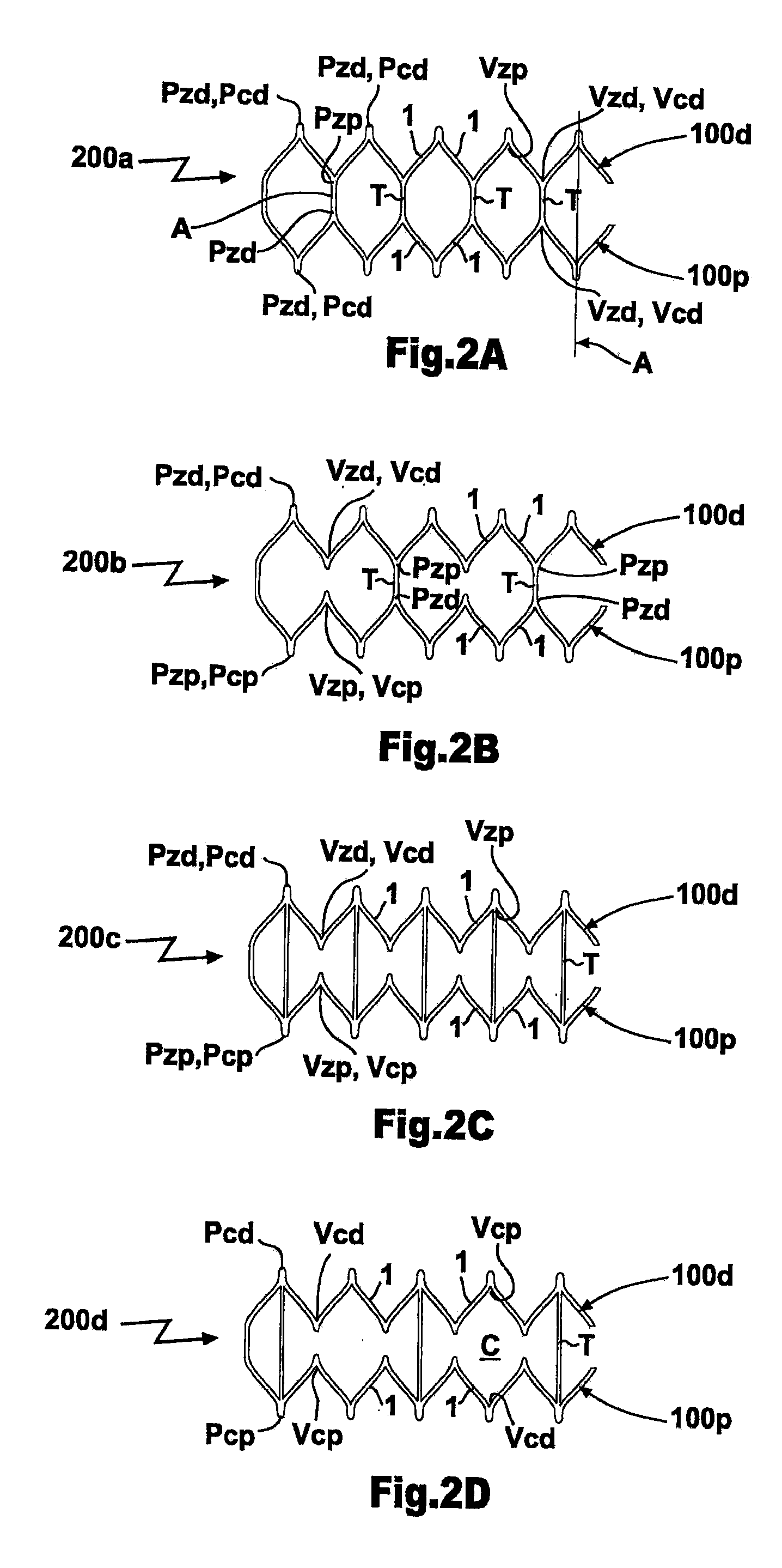 Multi-Segment Modular Stent And Methods For Manufacturing Stents