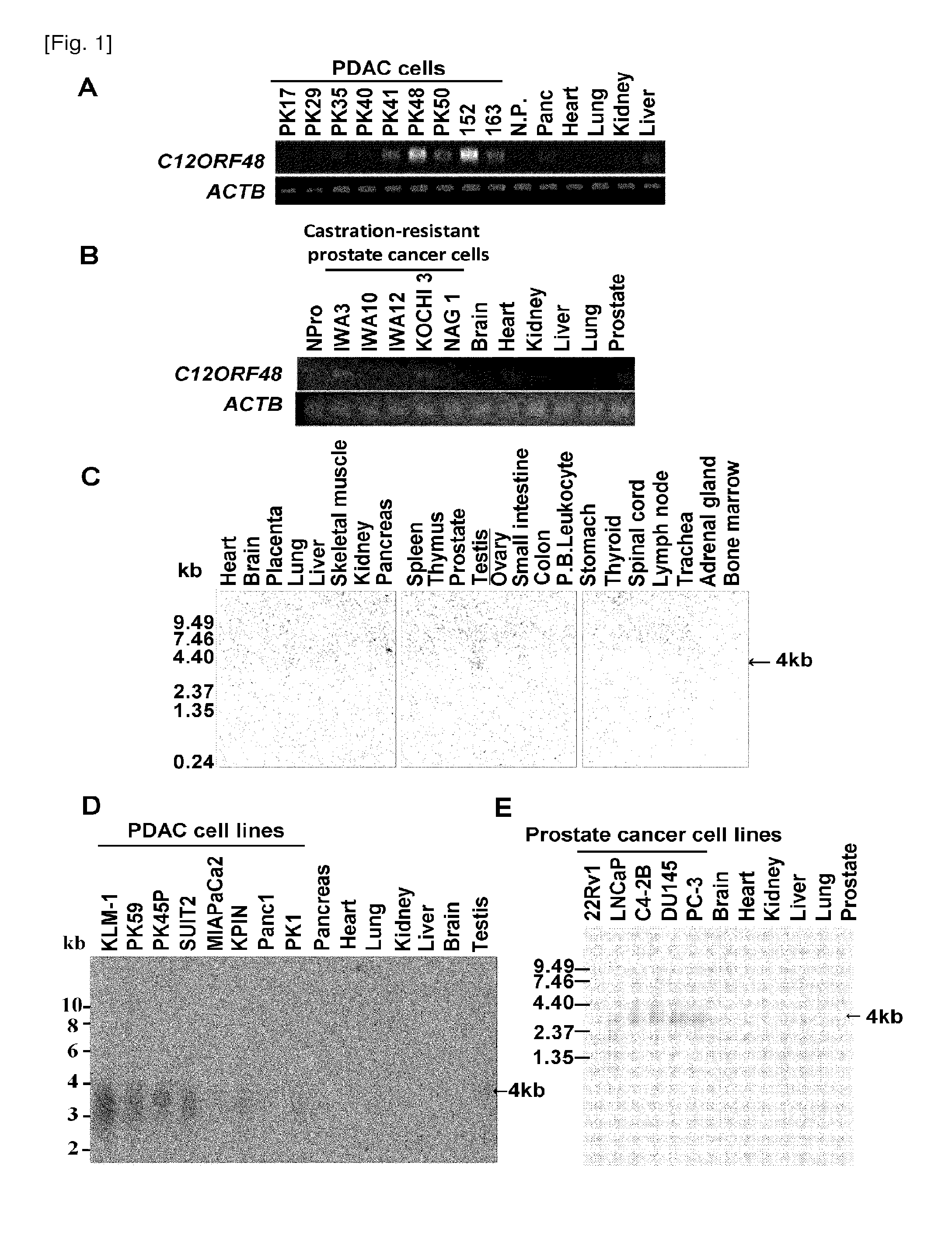 C12orf48 as a target gene for cancer therapy and diagnosis