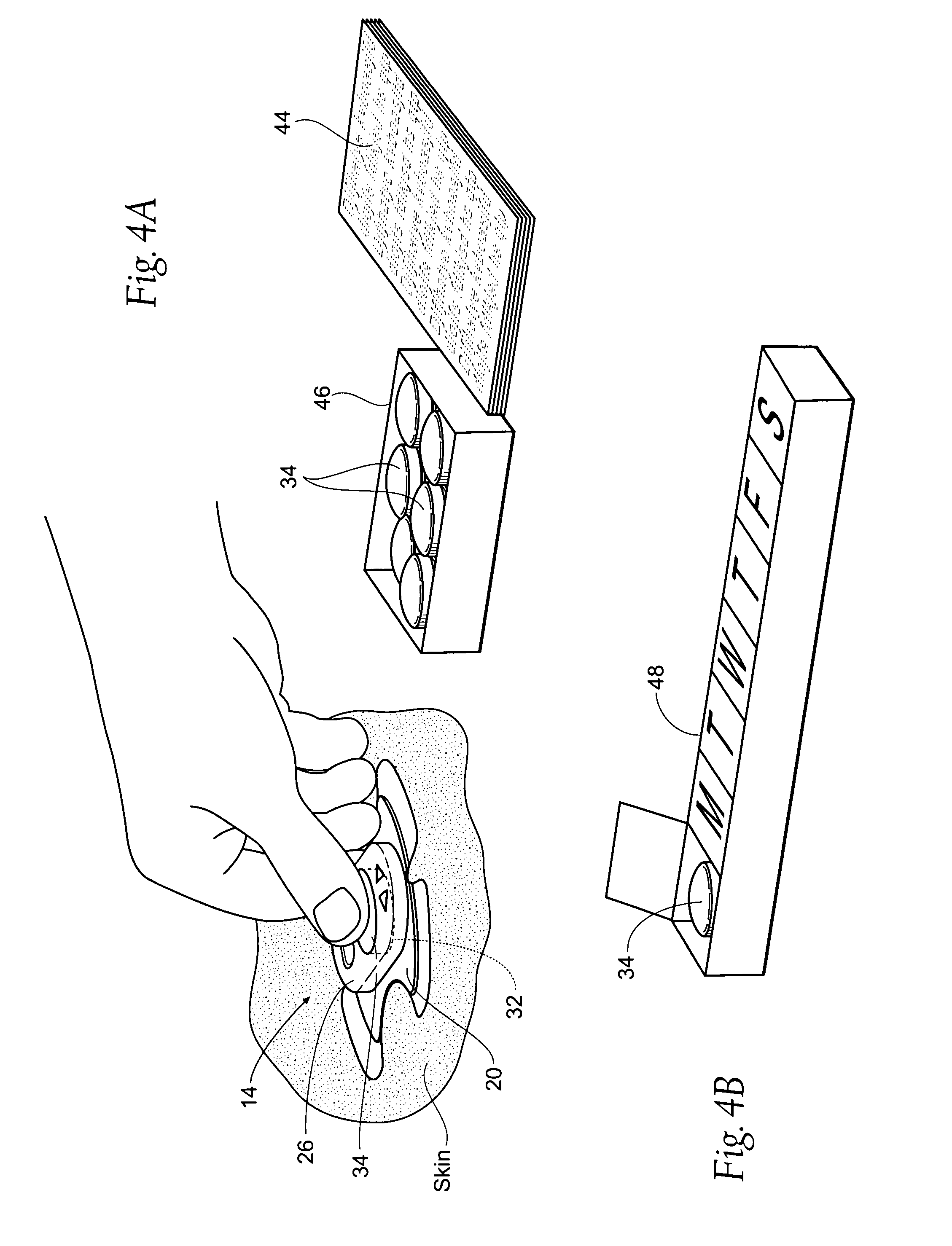 Systems and methods for a trial stage and/or long-term treatment of disorders of the body using neurostimulation