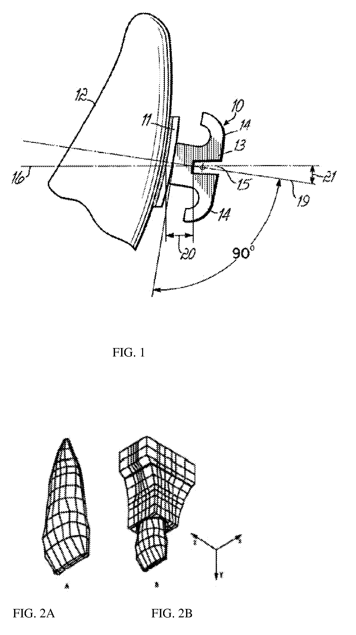 Tooth movement system and method