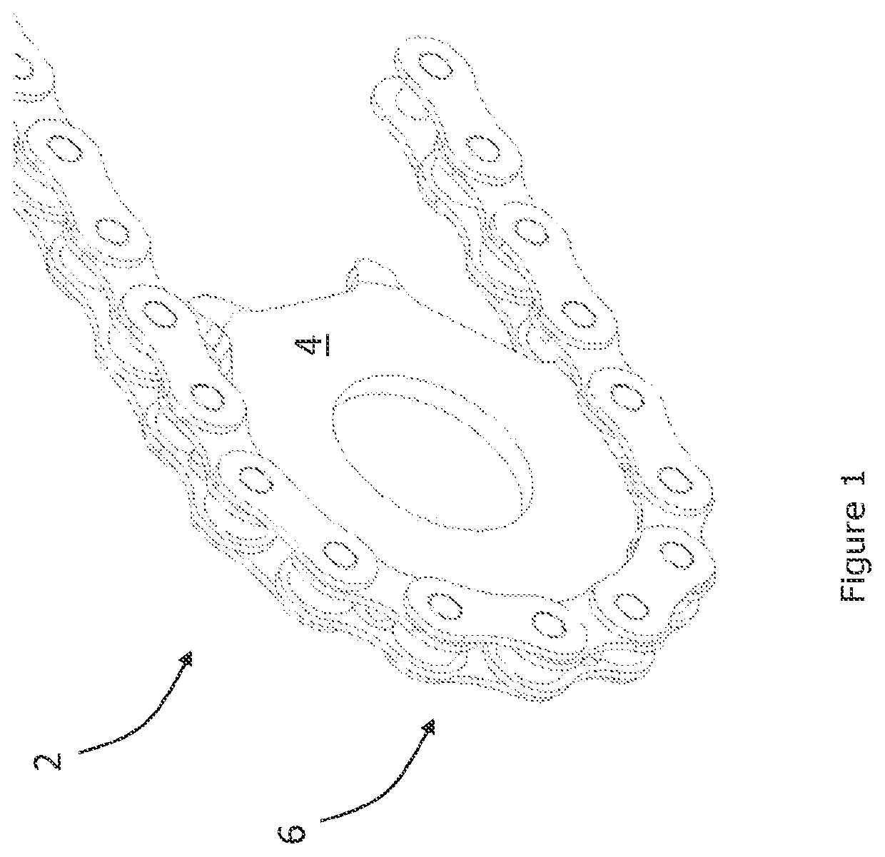 Transmission system