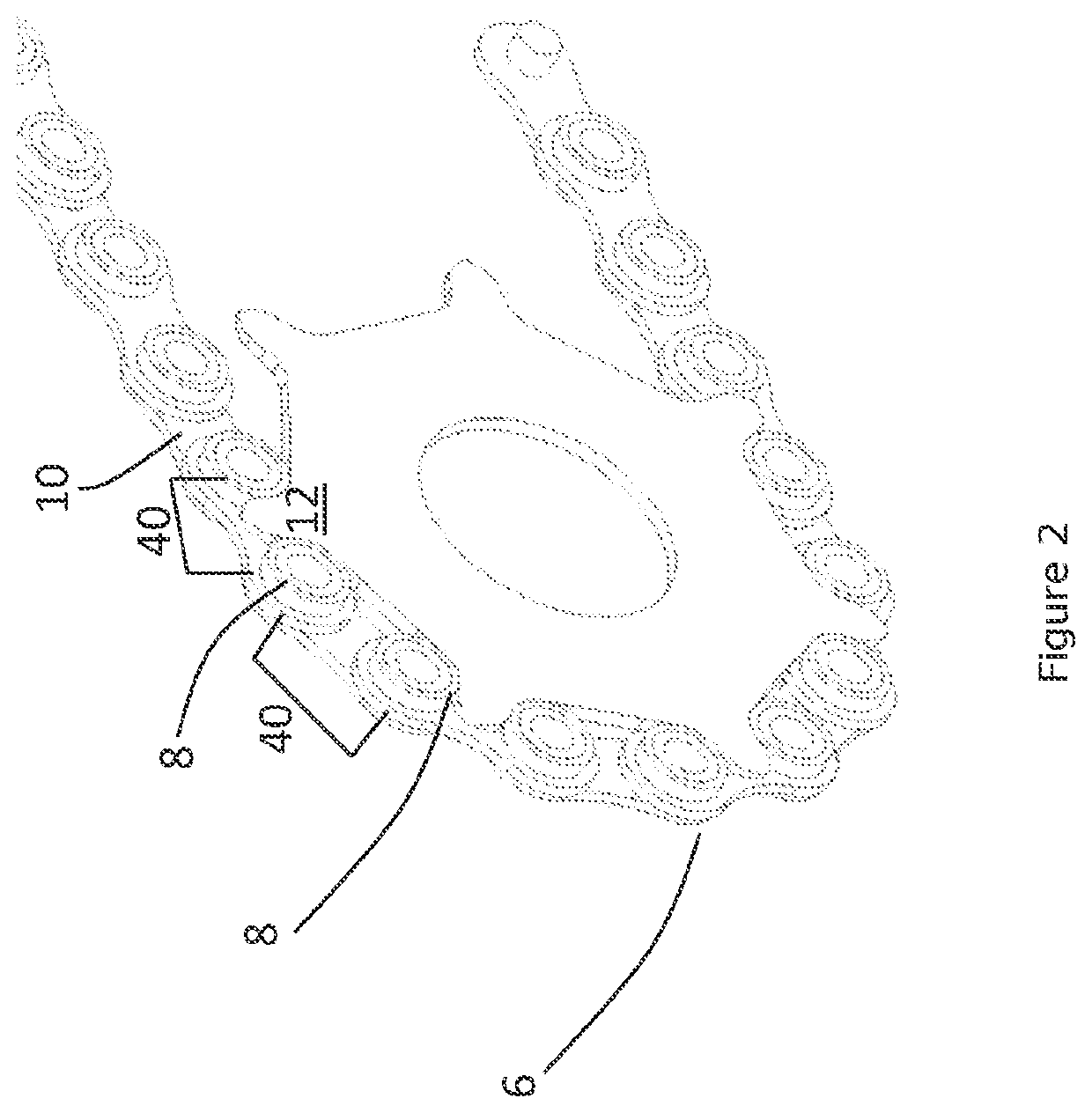 Transmission system