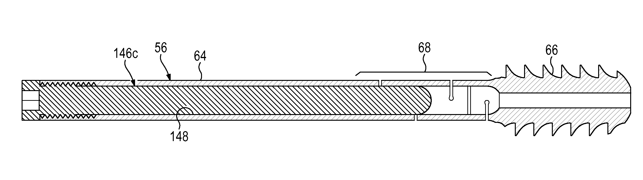 Hip fixation system with a compliant fixation element