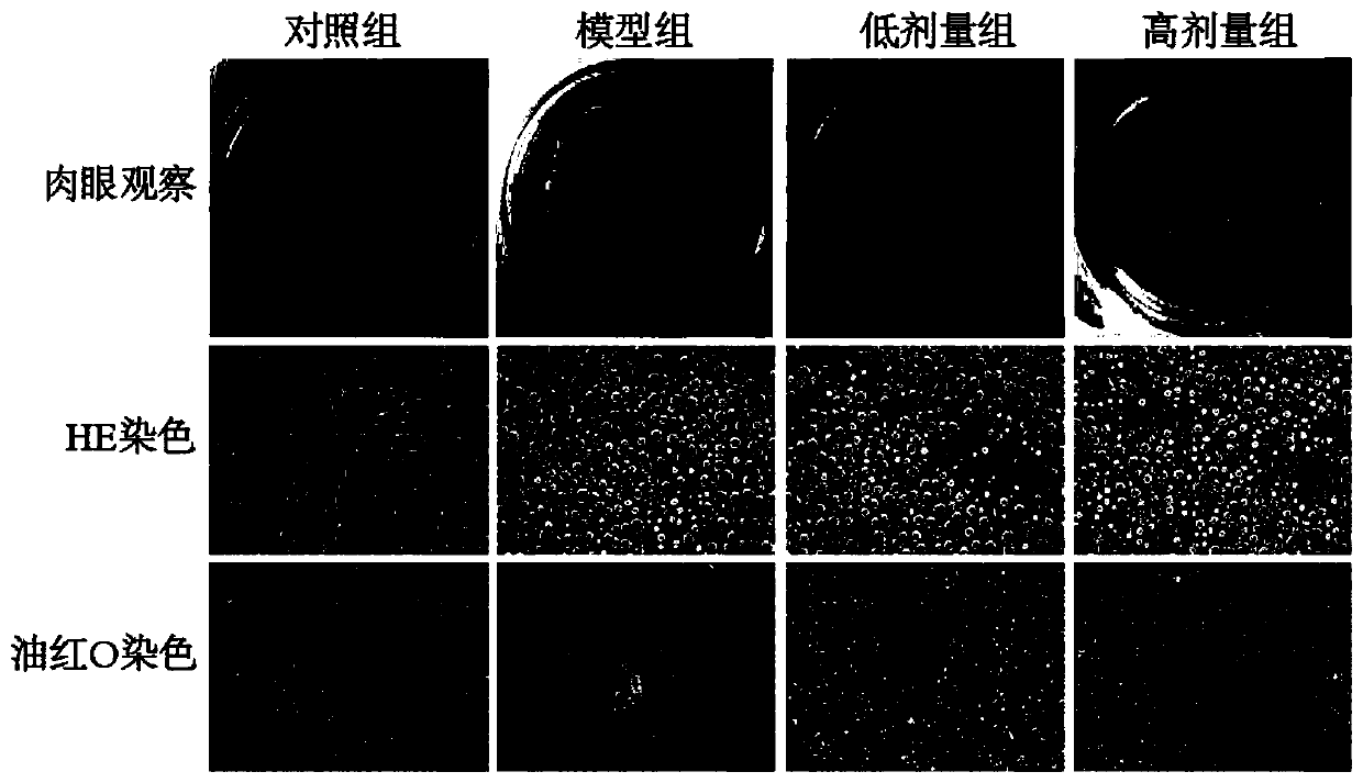 Traditional Chinese medicine composition for relieving nonalcoholic steatohepatitis and preparation method and product thereof