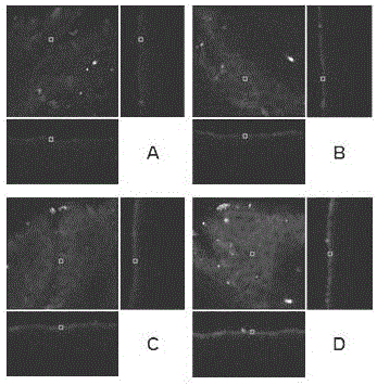 Detection method on basis of taking epidermal keratin and associated protein thereof as biomarkers for predication and detection of ultraviolet injuries and application of detection method