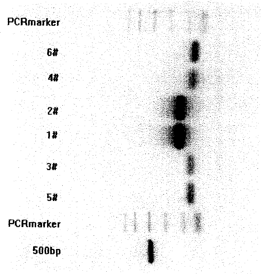 Secretory expression for human insulin gene in methyl alcohol yeast