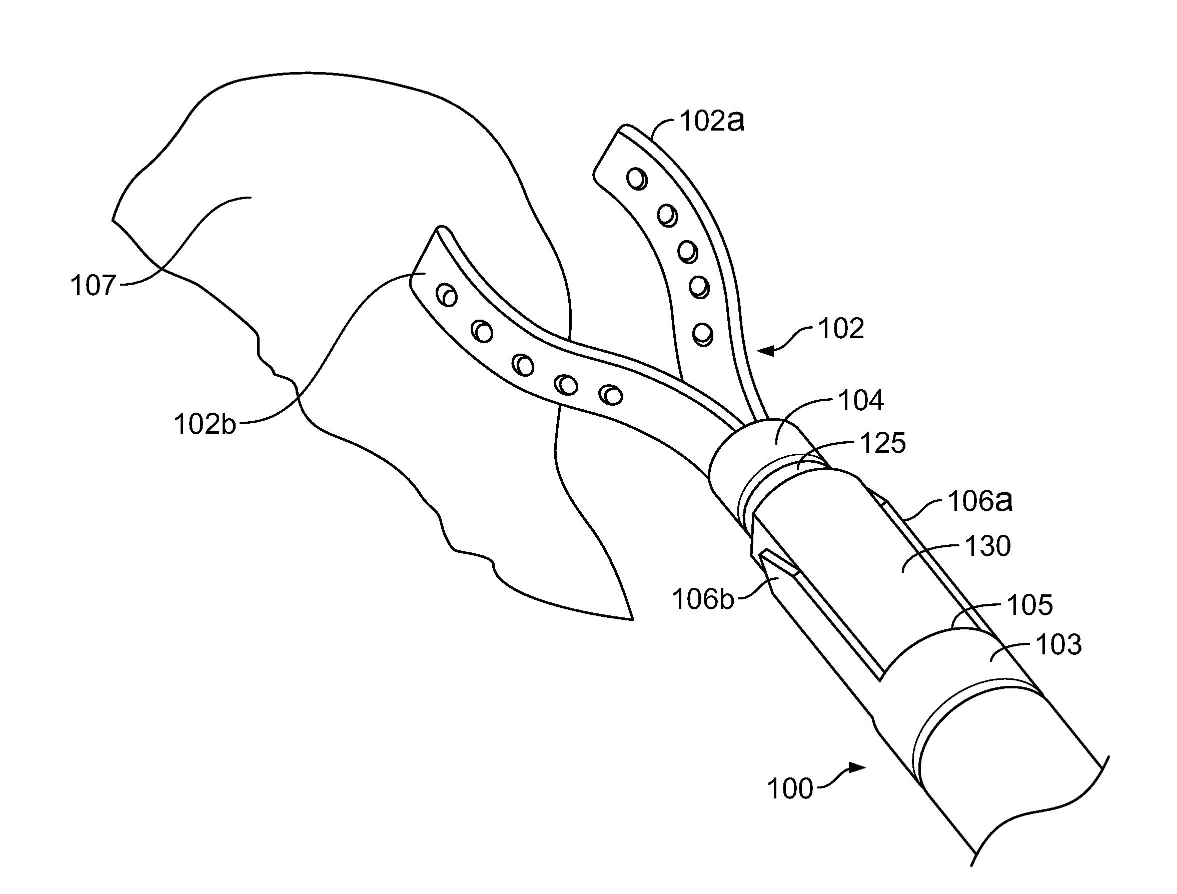 Tissue Retractor Assembly