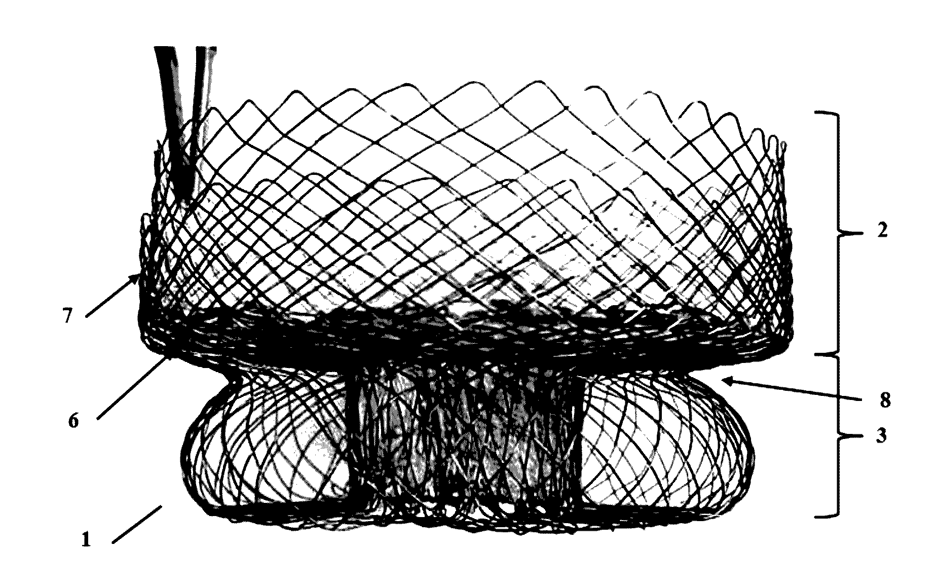 Heart valve anchoring device