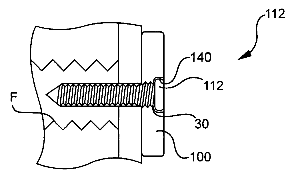 Self-guiding threaded fastener