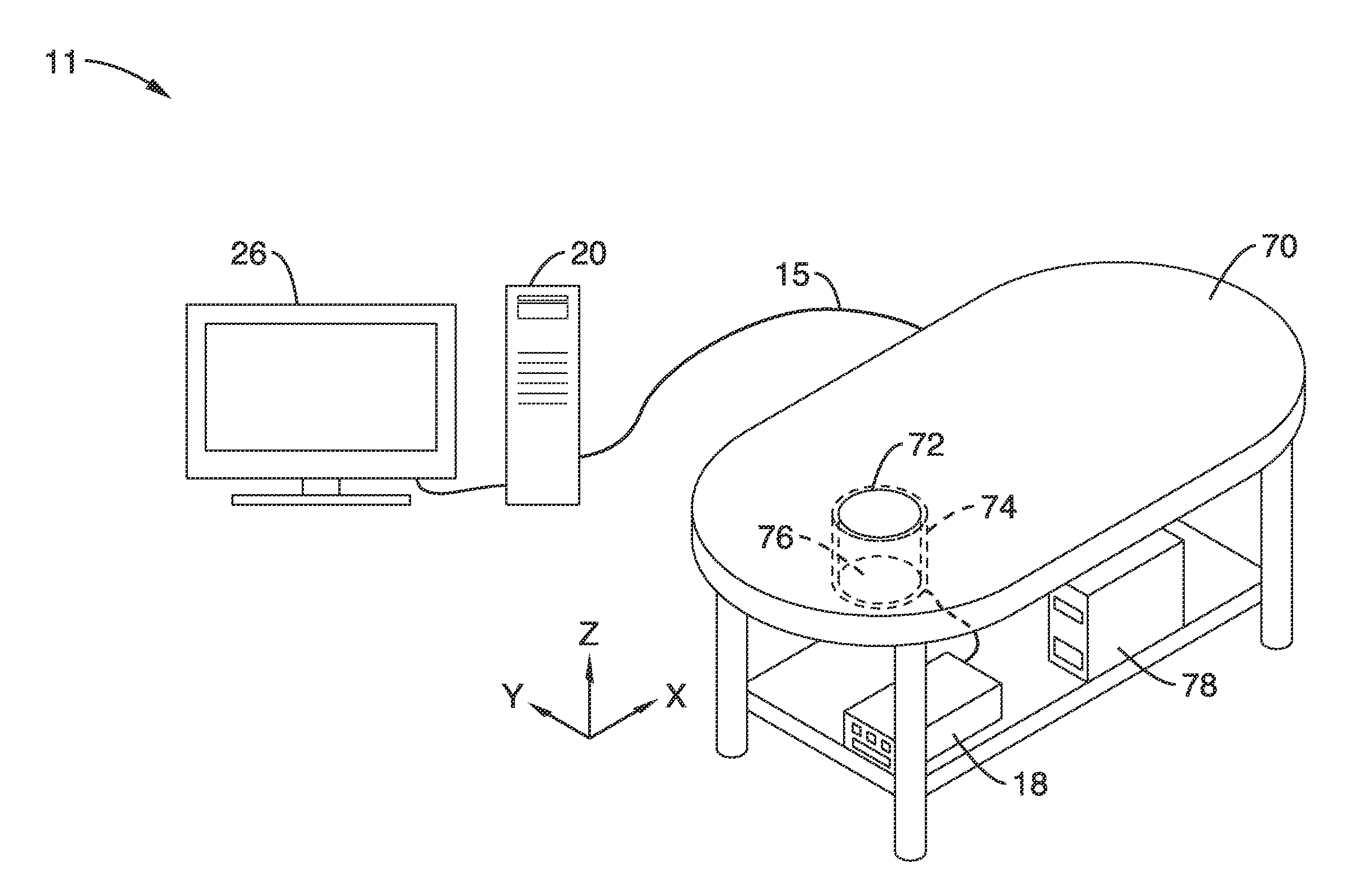 Ultrasound waveform tomography with TV regularization