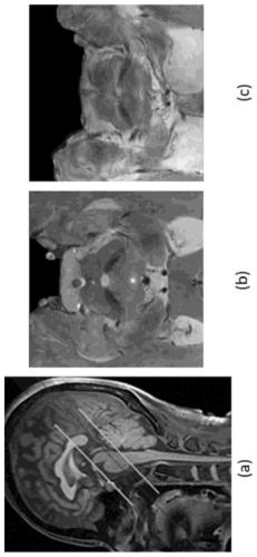 Parkinson's disease diagnosis apparatus and method