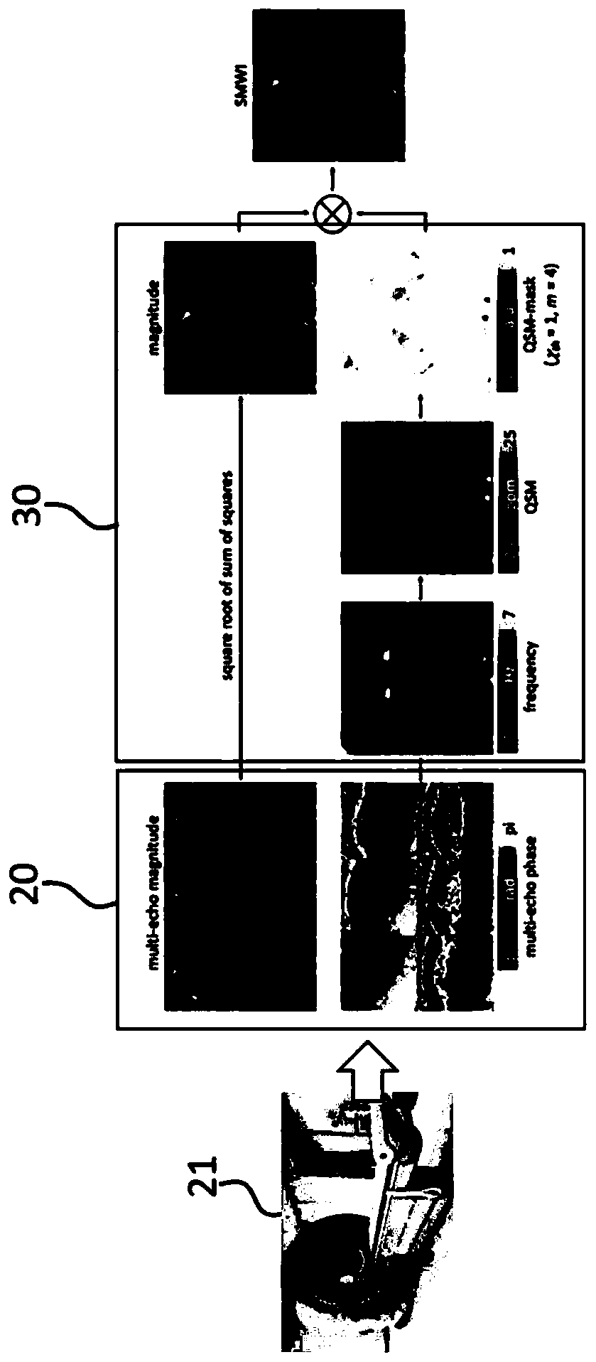 Parkinson's disease diagnosis apparatus and method