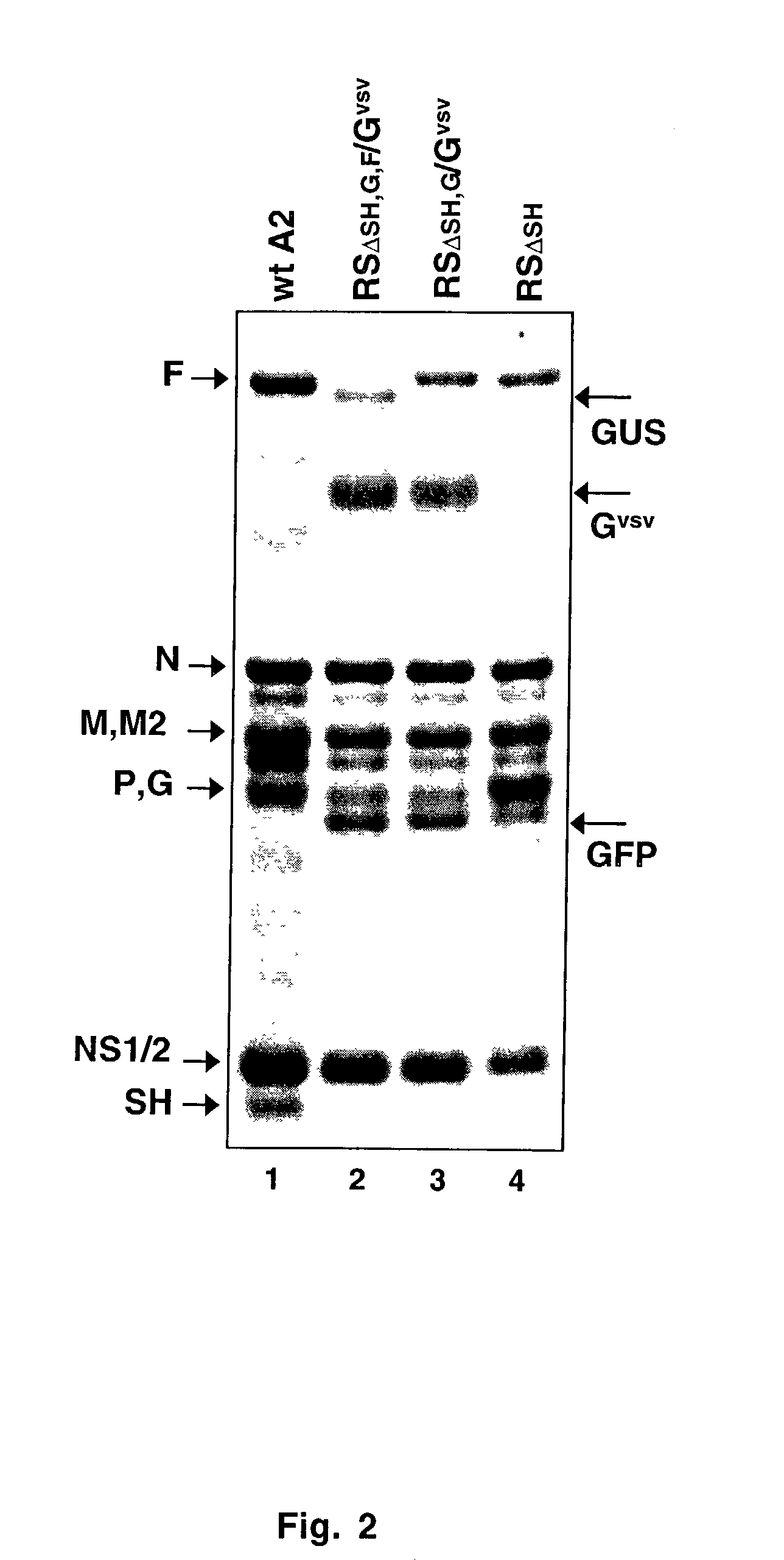 Recombinant respiratory syncytial viruses with deleted surface glycoprotein genes and uses thereof