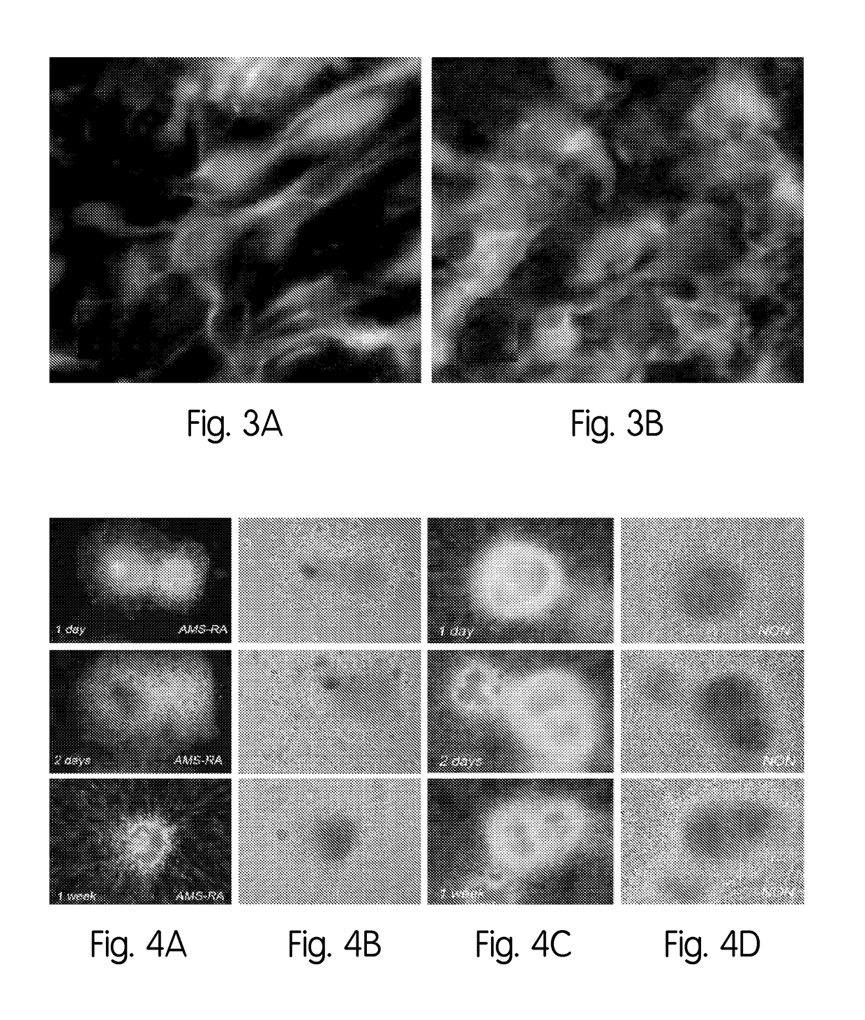 Method for stem cell differentiation in vivo by delivery of morphogenes with mesoporous silica and corresponding pharmaceutical active ingredients