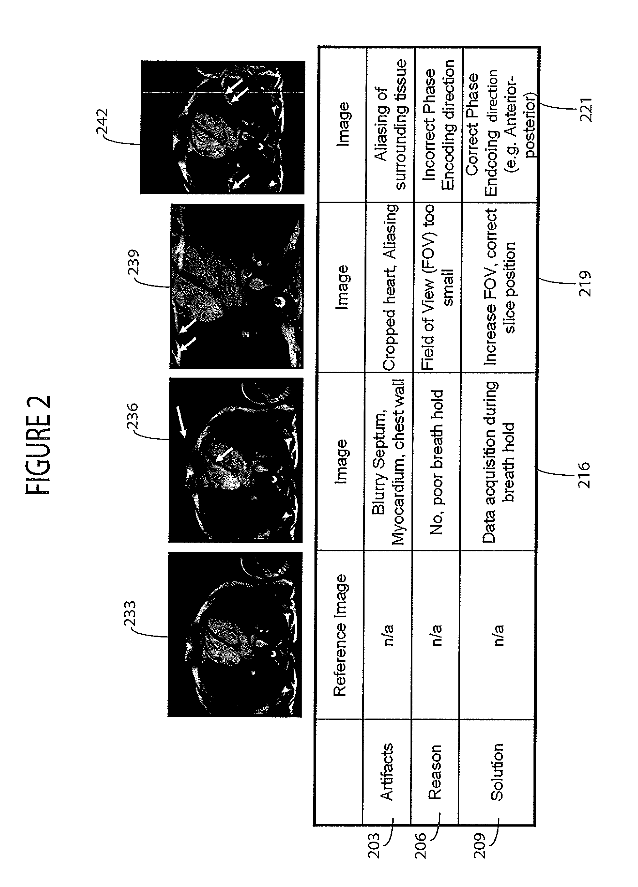 System for Dynamically Improving Medical Image Acquisition Quality