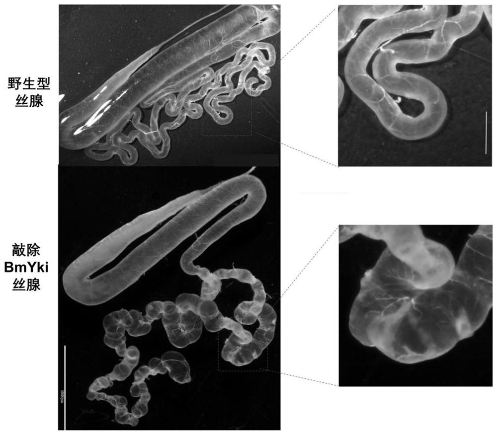 Transgenic method for improving content of silk fibroin in silkworm cocoon and silkworm variety thereof