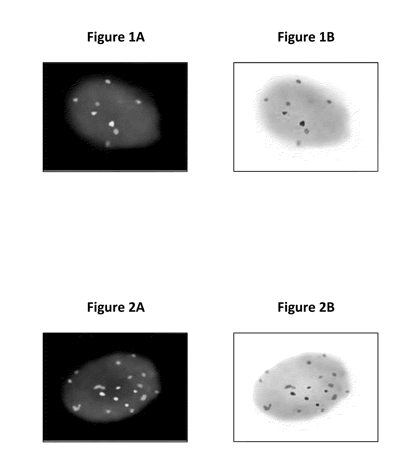 System and method for detecting abnormalities in cervical cells
