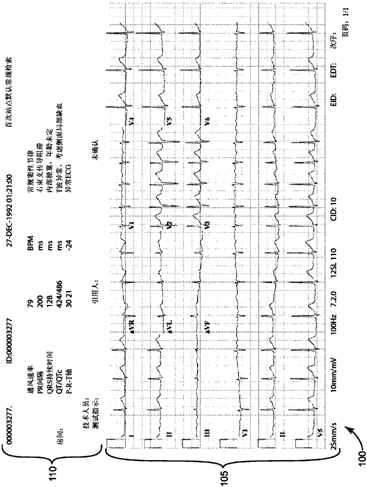 System for providing electrocardiogram (ECG) analytics for electronic medical records (EMR)