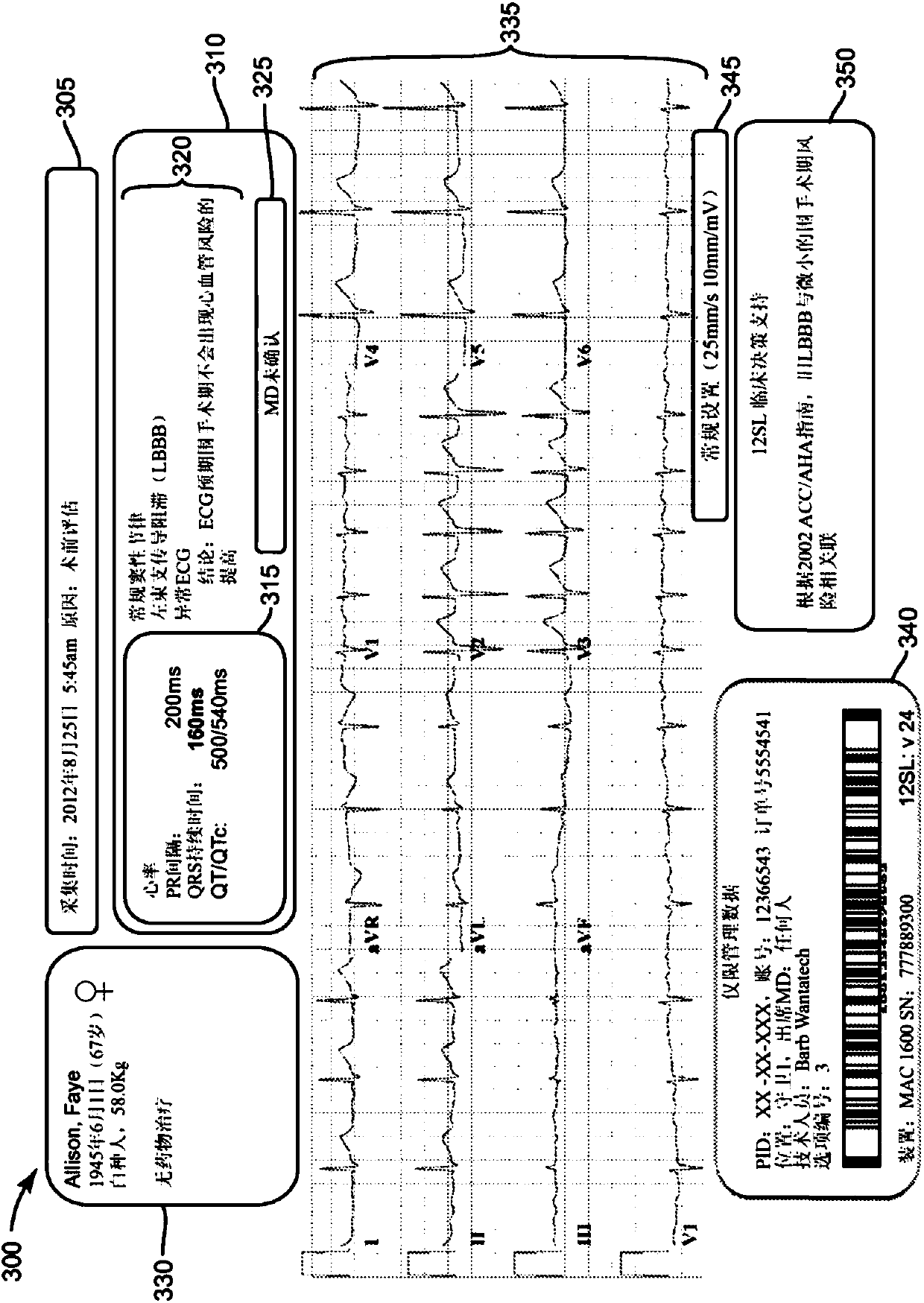 System for providing electrocardiogram (ECG) analytics for electronic medical records (EMR)