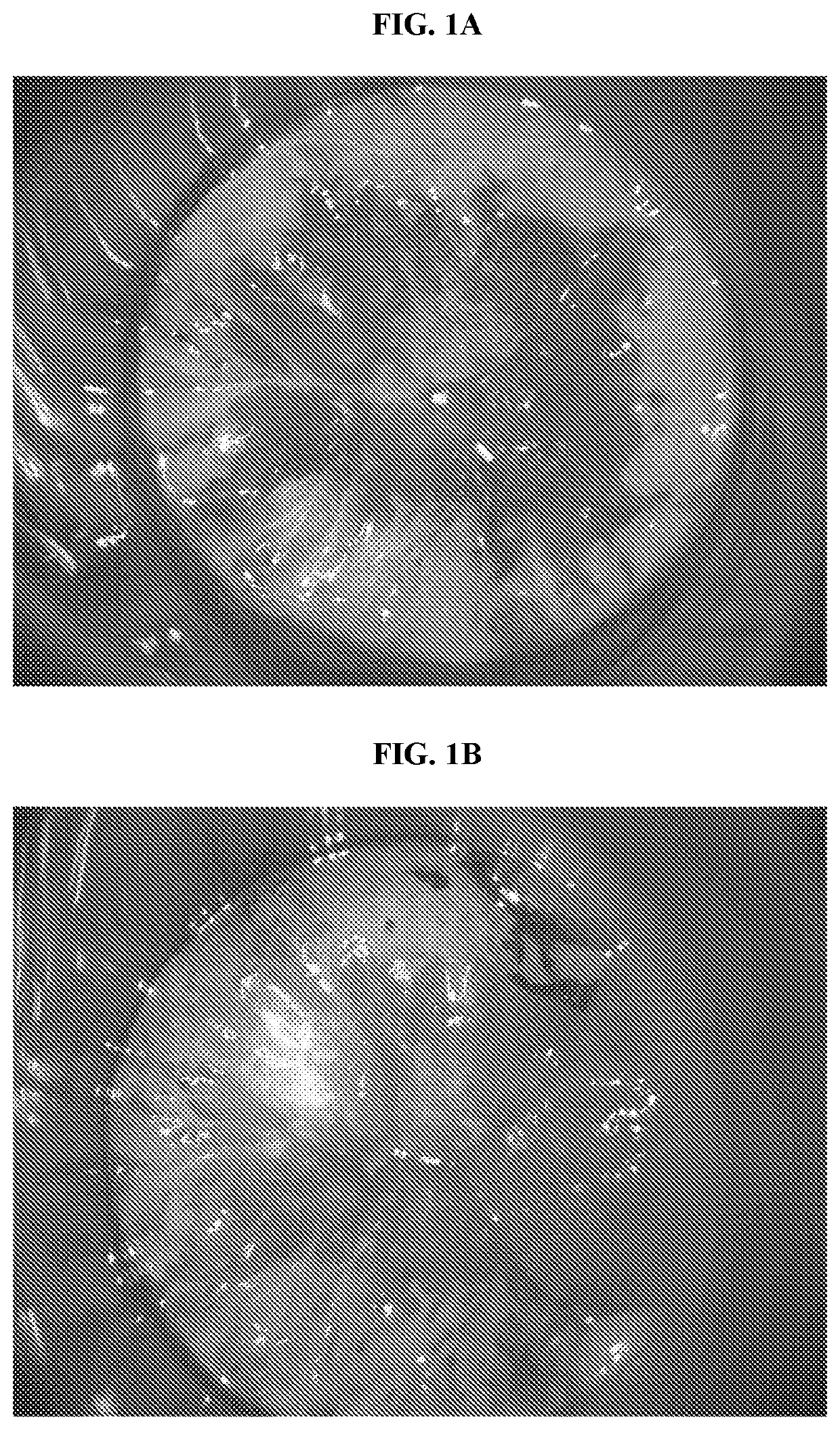 Treatment and prevention of anal conditions