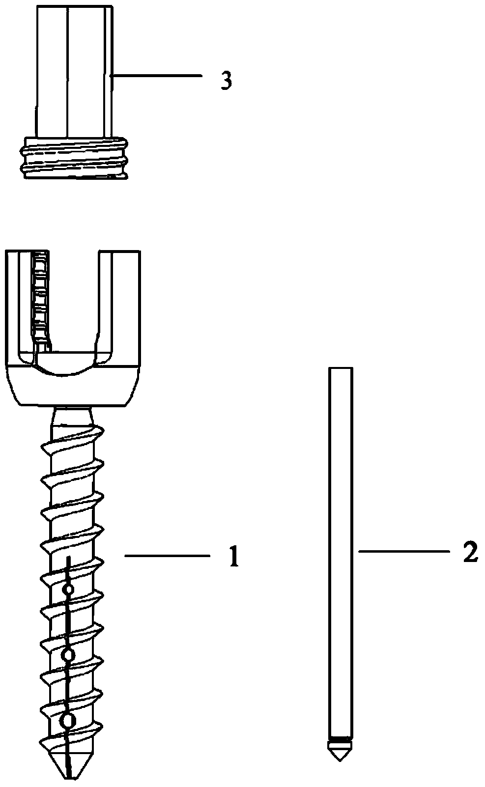 Multifunctional bone screw applied to bone with poor sclerotin condition