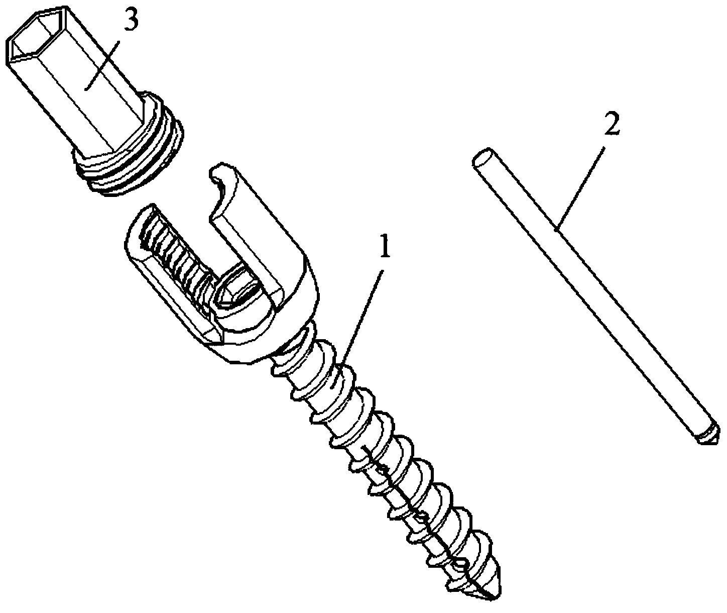 Multifunctional bone screw applied to bone with poor sclerotin condition