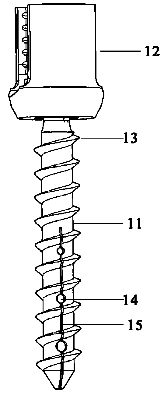 Multifunctional bone screw applied to bone with poor sclerotin condition