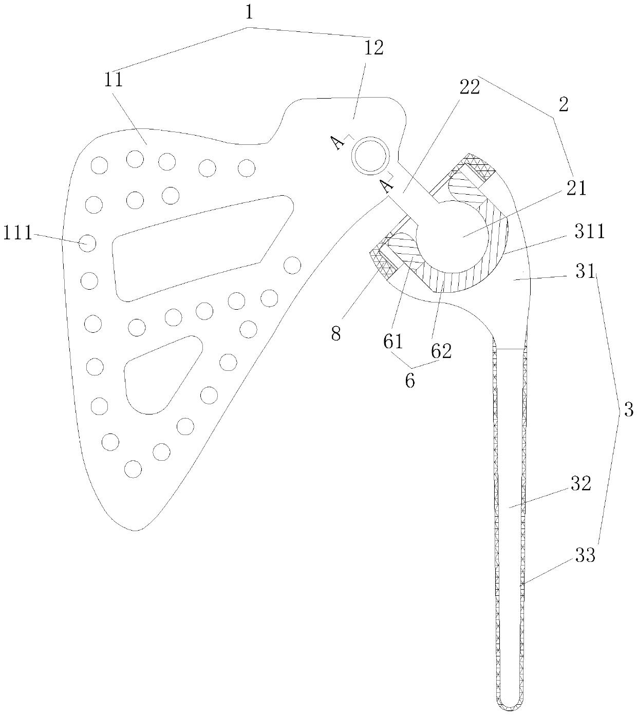 Assembly type shoulder joint prosthesis and manufacturing method thereof