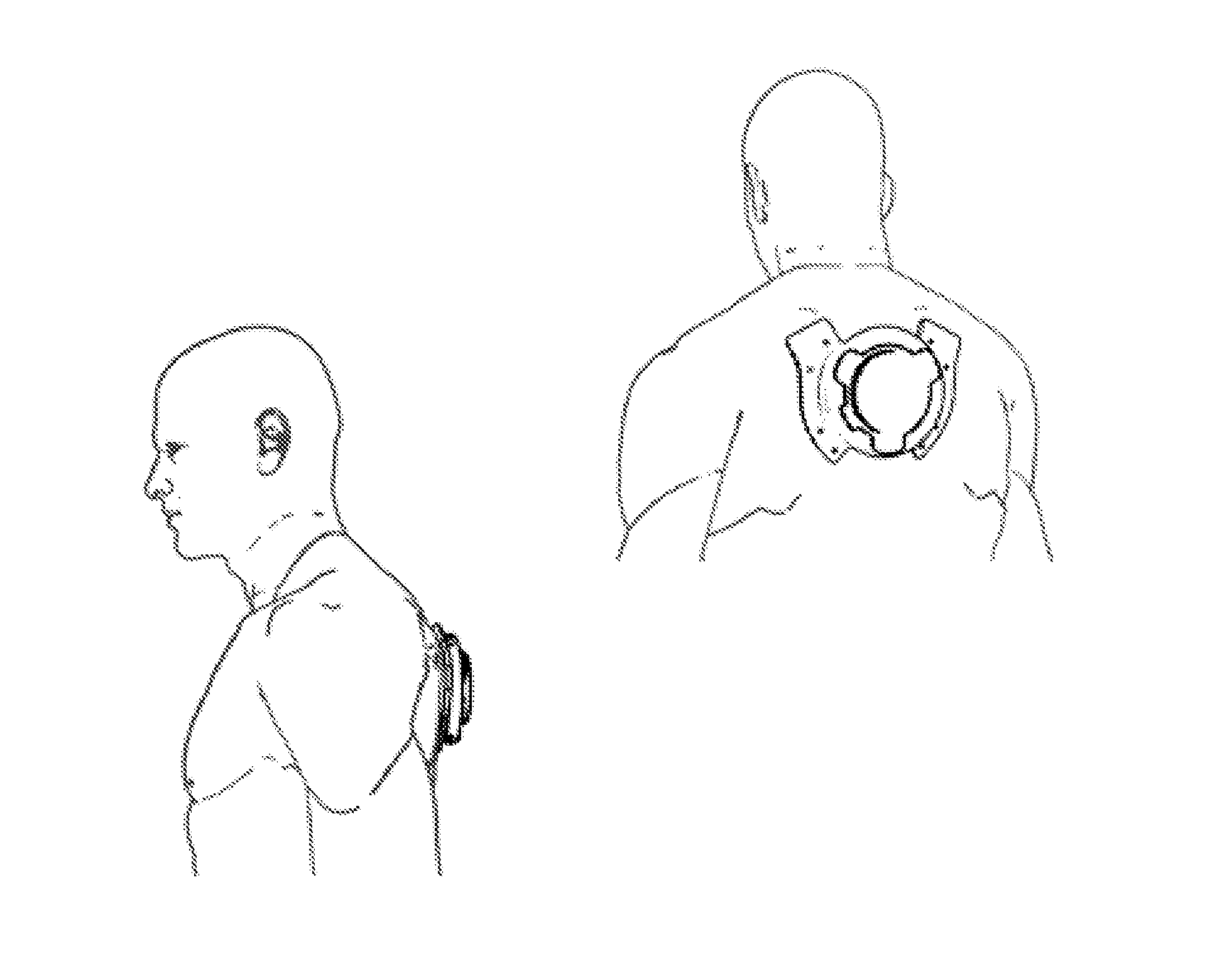 Rigid fixture for coupling one or more transducers to the upper back of the human body