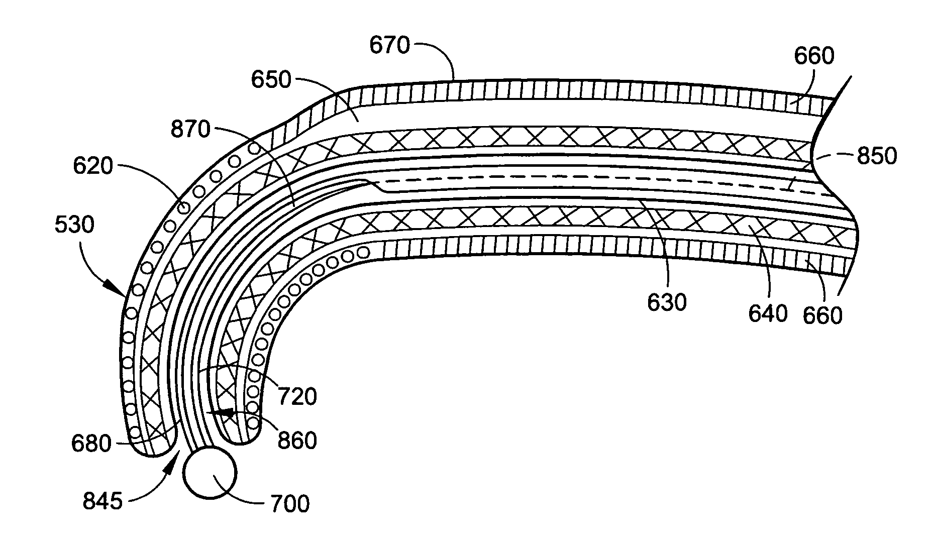 Radio-frequency-based catheter system with improved deflection and steering mechanisms