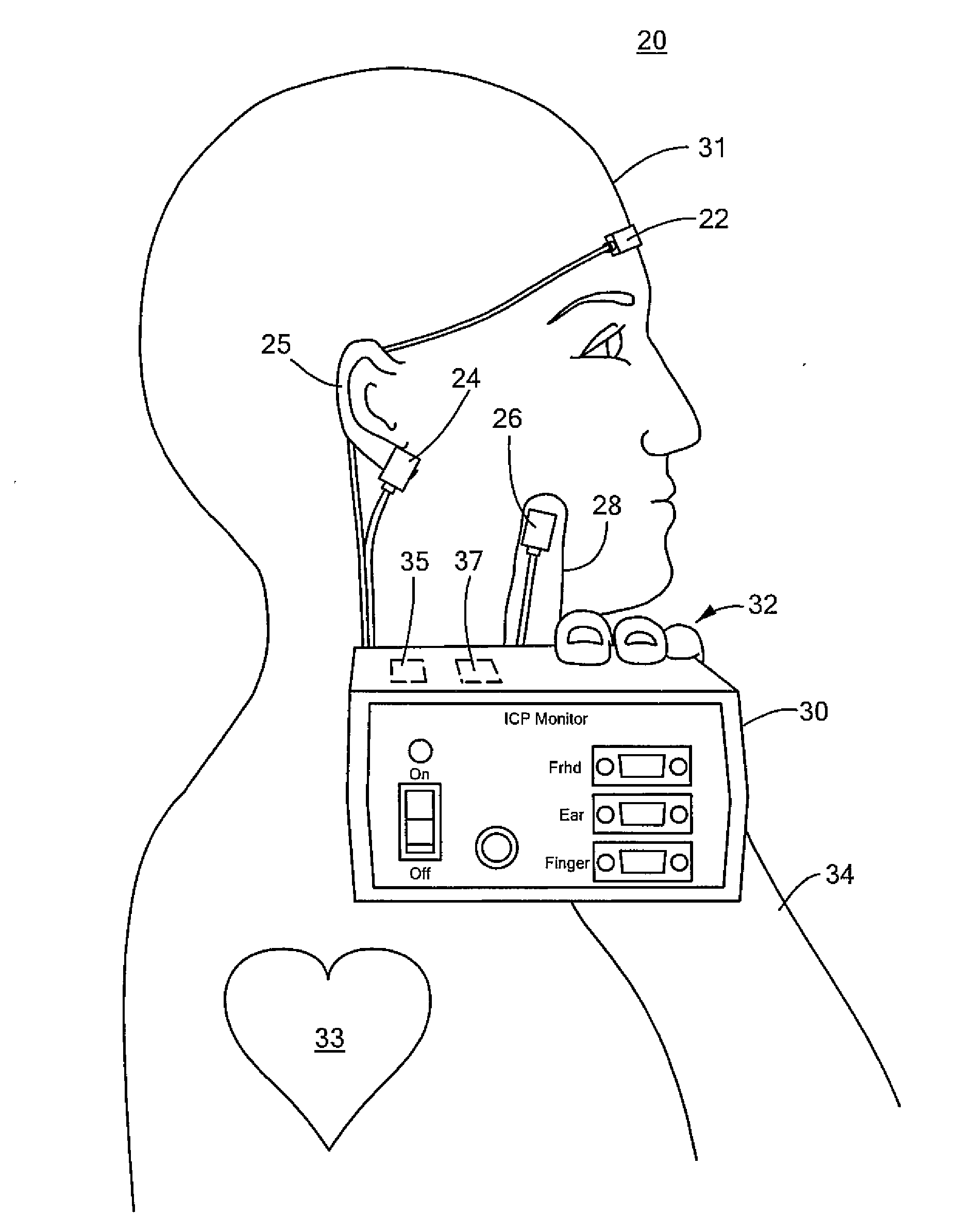 Non-invasive intracranial pressure monitoring system and method thereof