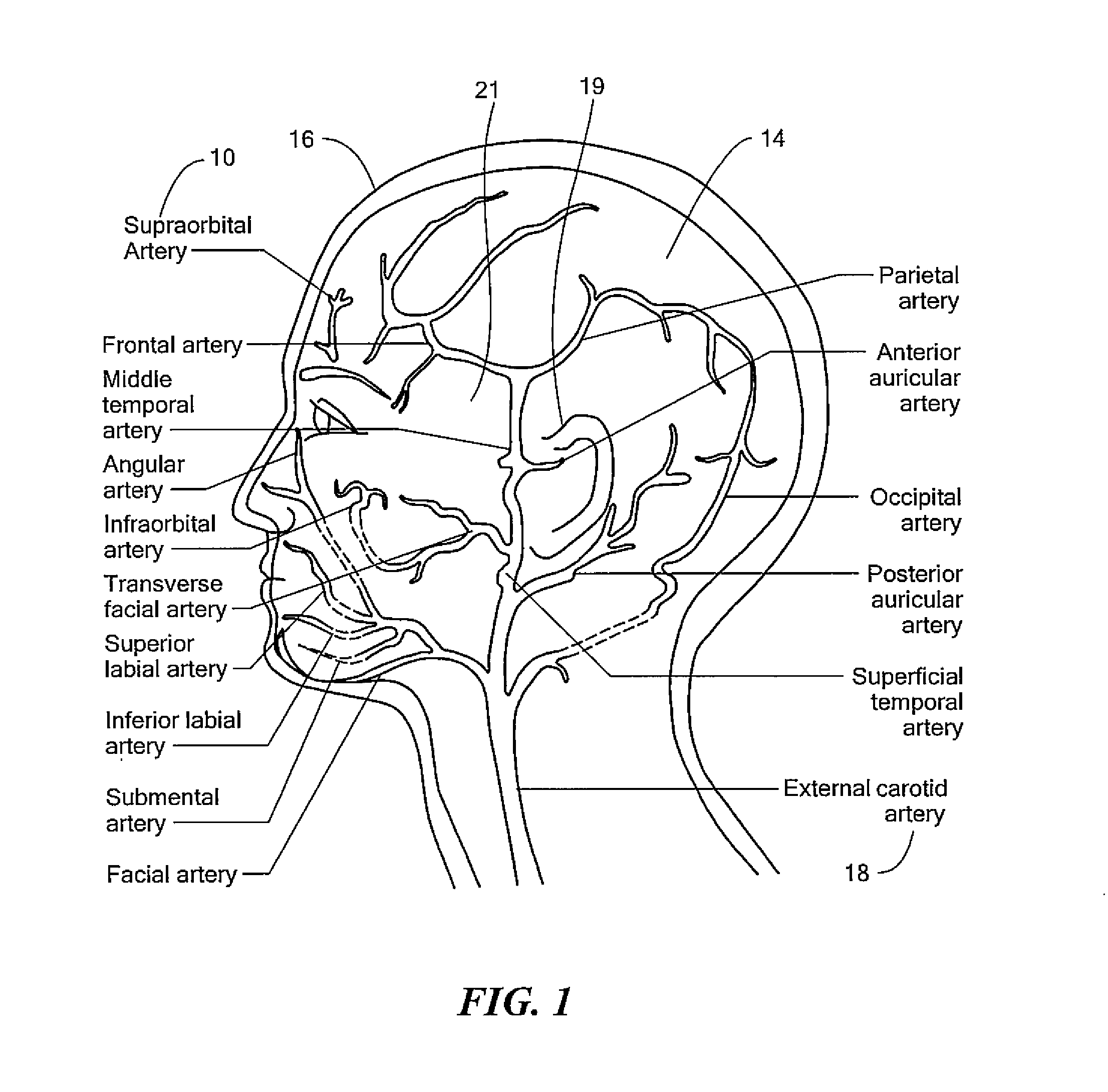 Non-invasive intracranial pressure monitoring system and method thereof