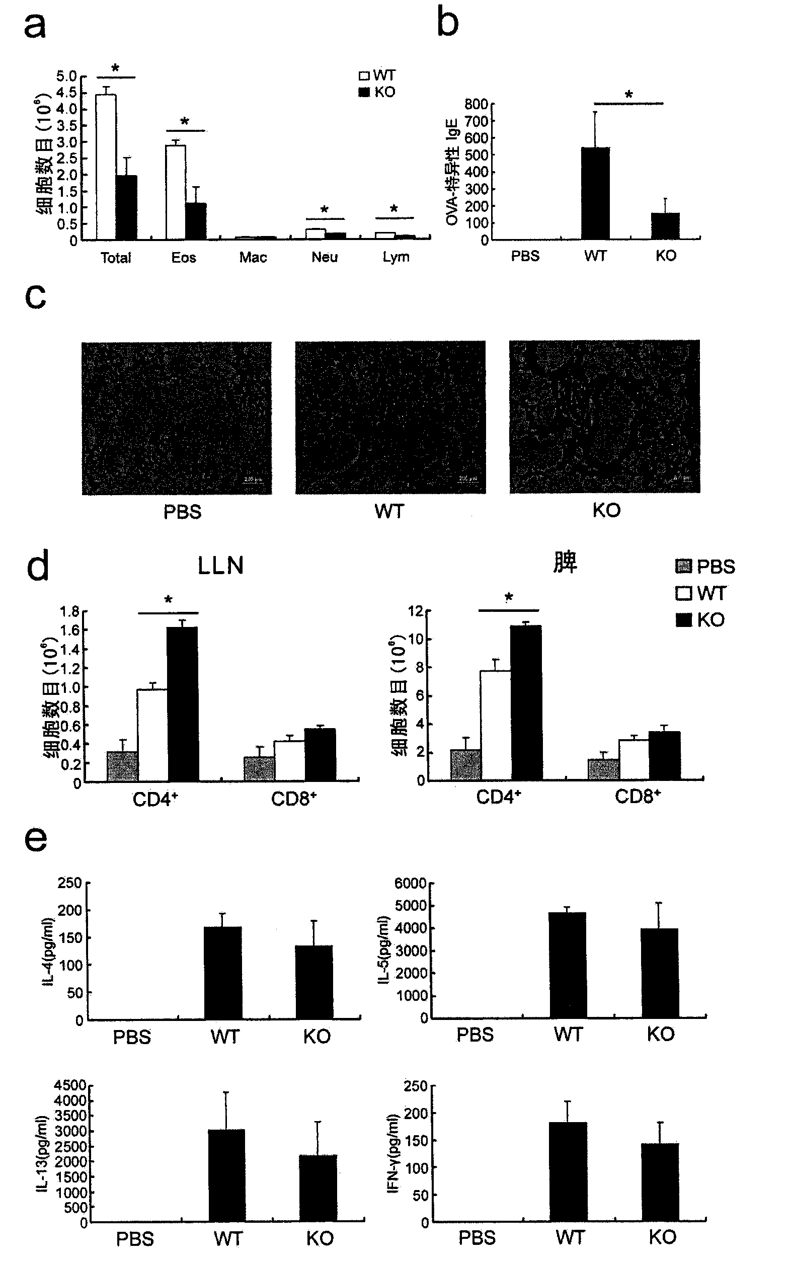 Application of extracellular matrix protein 1 and regulator thereof in preparing medicament for diagnosing or treating allergic diseases