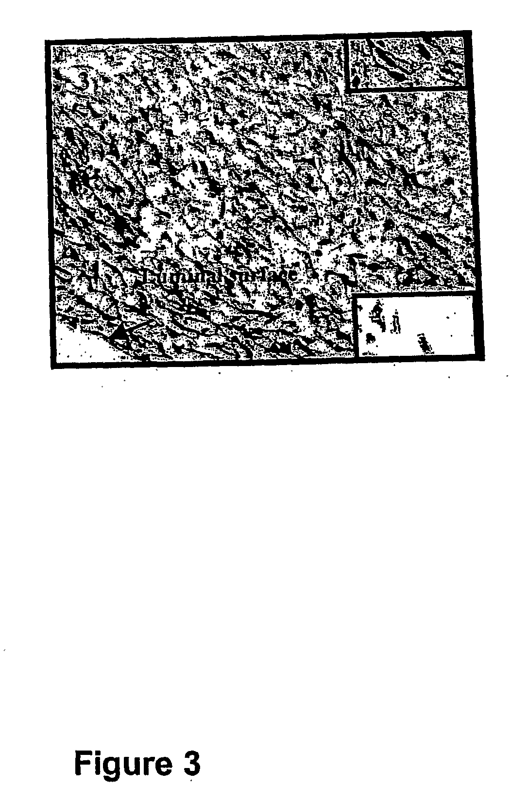Methods And Compositions For The Treatment Of Graft Failure