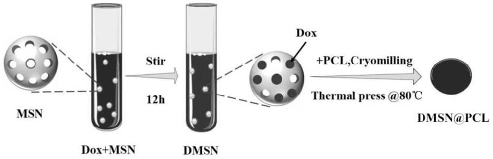 Preparation method and application of a nanocomposite material for inhibiting postoperative tumor recurrence